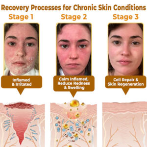 BeeRx Bee Venom Skin Restoration Cream