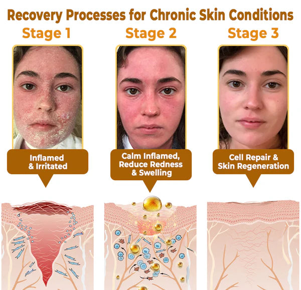BeeRx Bee Venom Skin Restoration Cream